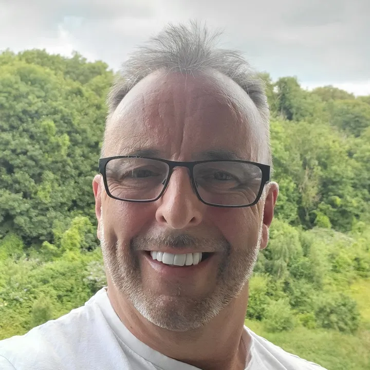 Paul Allen after treatment at Maypark Dental