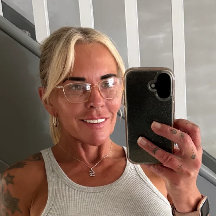 Sharon McNamee after treatment at Maypark Dental