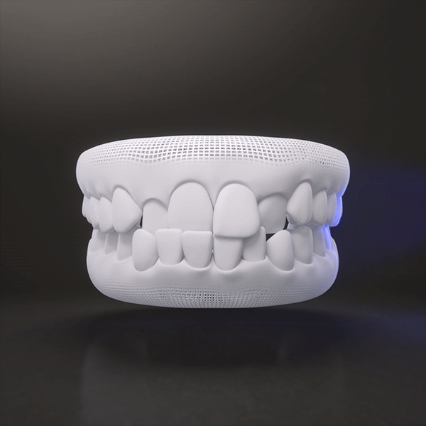 3D animation of bite correction with Invisalign aligners in Dublin