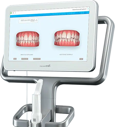 iTero screen showing Invisalign smile simulation at Dublin dental clinic