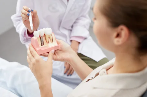 Understanding the types of dental implants available