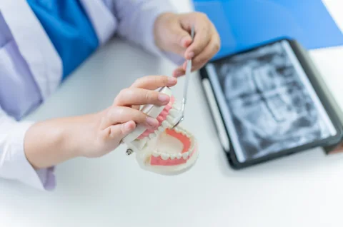 Can dental implants be done in one day?
