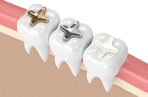 Fillings