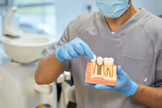 How long do dental implants last before replacement