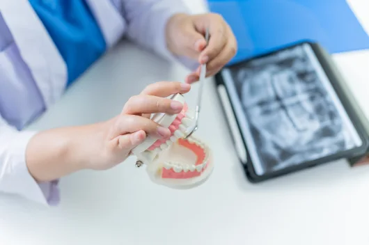 Can dental implants be done in one day?