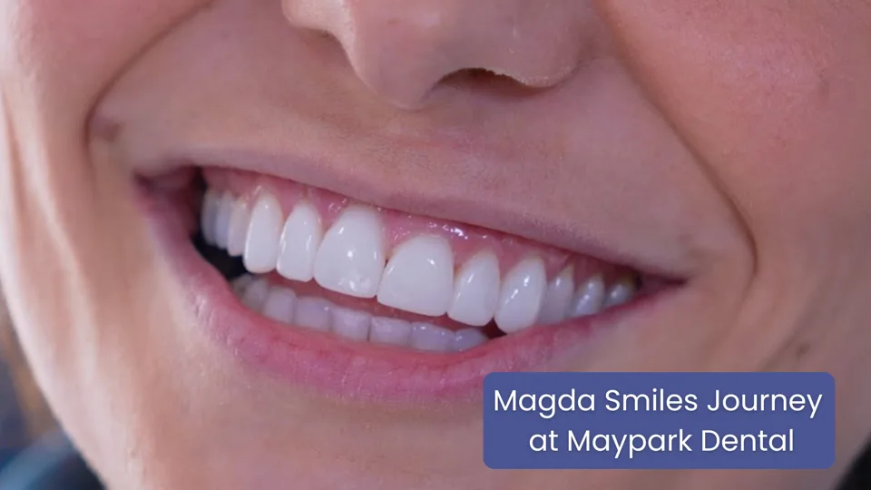 Teeth whitening