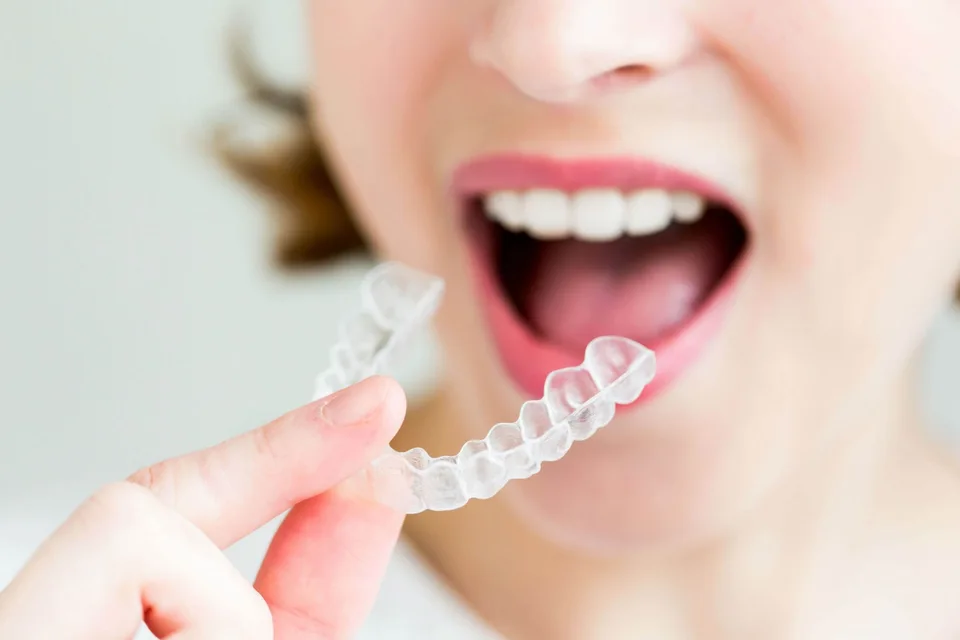 Invisalign Aligners Dublin