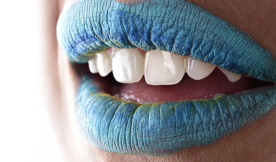 Teeth Whitening