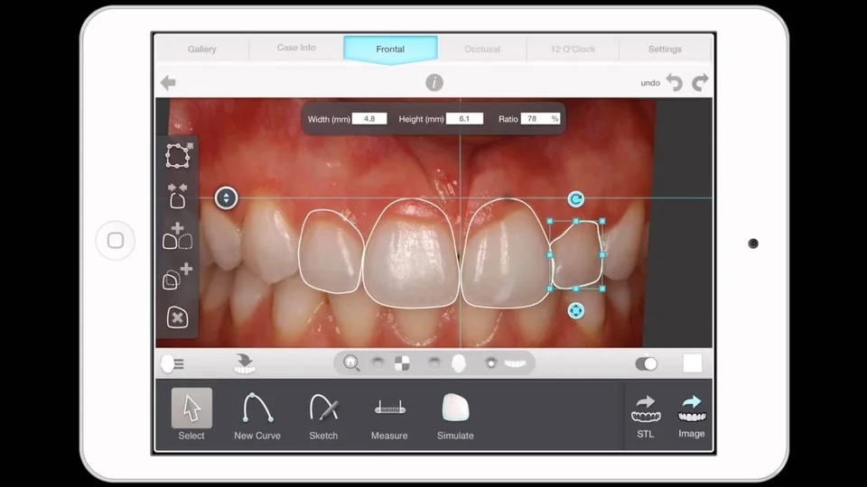 Digital Smile Design Dublin