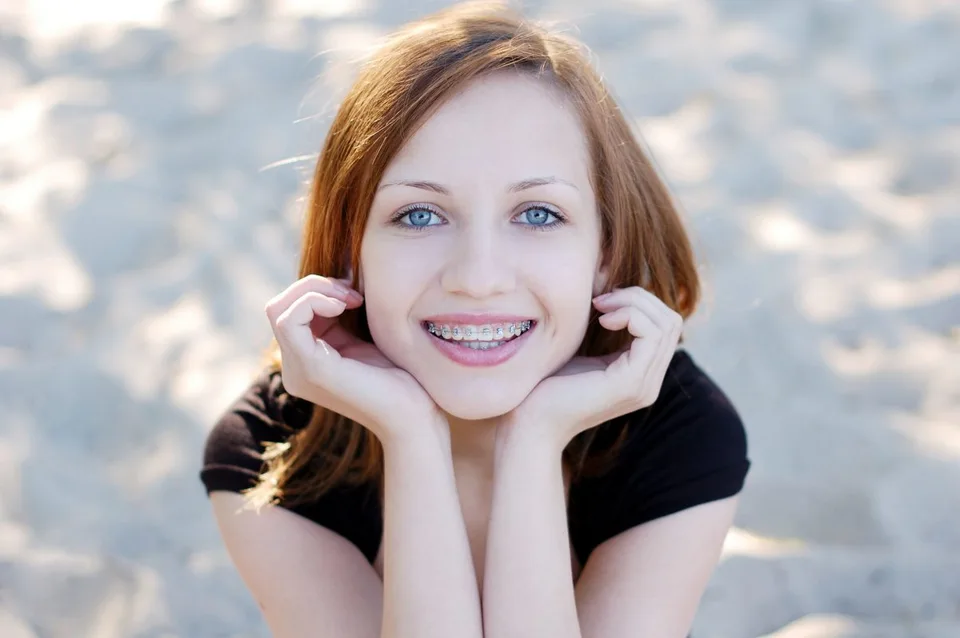 Metal braces