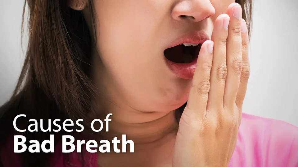 Bad Breath